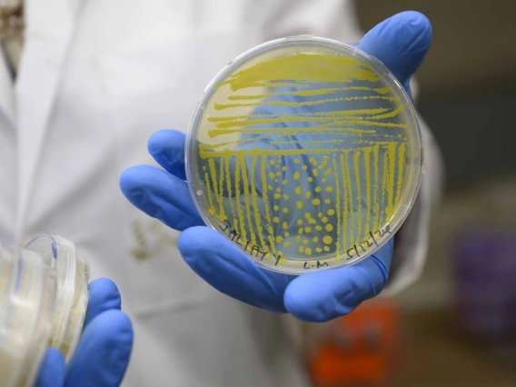 A petri dish stained yellow with bacteria