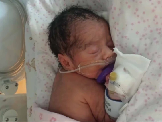 Infant in a hospital crib with oxygen tube in nose