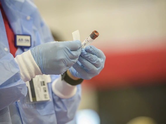 A health care worker labels a sample after collection.