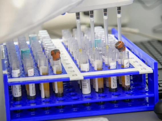 Barbara Fransway, manager of University of Arizona Genetics Core Research Services, transfers blood serum into testing plates.