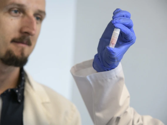 Paweł Łaniewski, PhD, selects cells preserved through cryopreservation. These cells might help establish a link between the vaginal microbiome and susceptibility to gynecologic cancers.