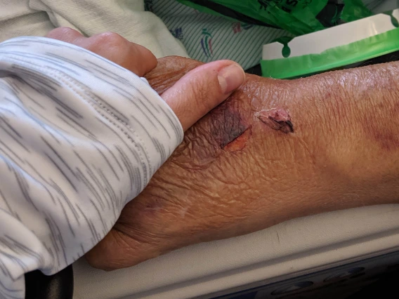 Tara Sklar, professor of health law and director of the Health, Law and Policy program at the University of Arizona James E. Rogers College of Law, holds her father’s hand for the last time while he was in hospice. (photo courtesy of Tara Sklar)