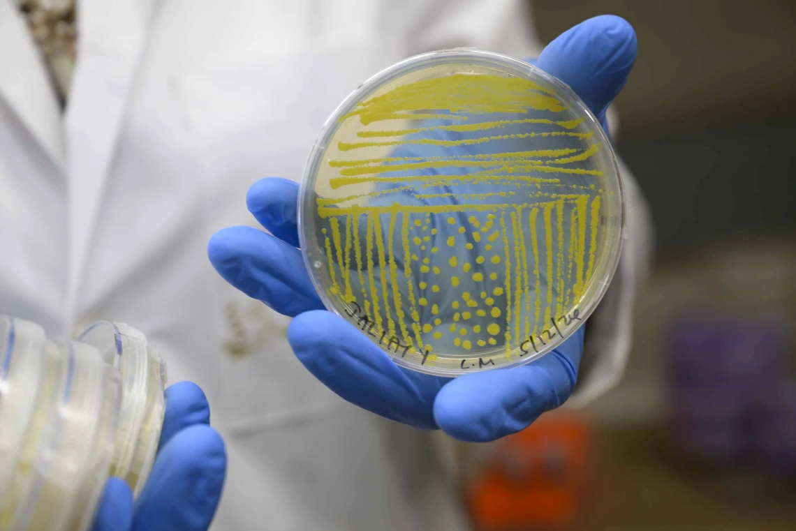 A petri dish stained yellow with bacteria