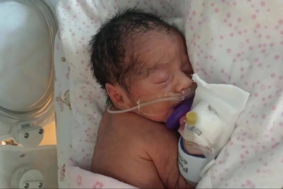 Infant in a hospital crib with oxygen tube in nose