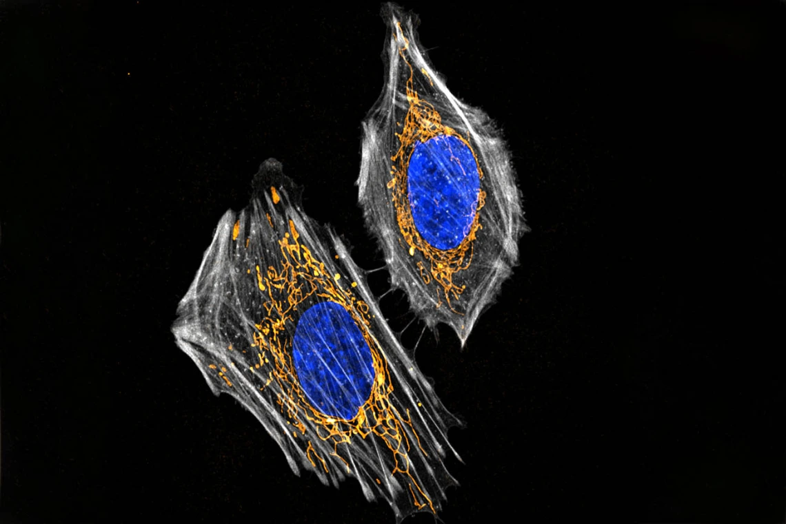 To investigate a hypothesis that decreased estrogen influences the brain during menopause, researchers use microscopes to visualize changes in a cell’s mitochondria (dyed orange) when estrogen activity is suppressed.  Image submitted by Marco Padilla-Rodriguez, PhD, microscopy specialist in the Brinton Lab at the Center for Innovation in Brain Science.