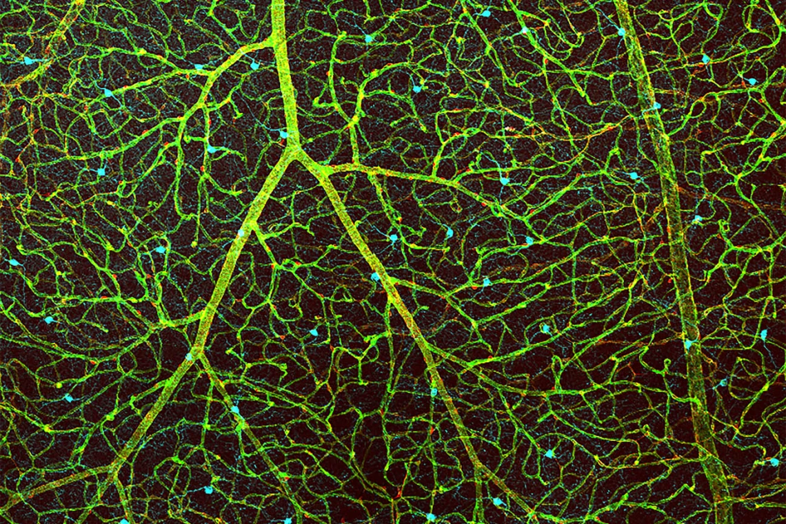 Does this look like an underwater plant or the vasculature of the retina? This image shows the blood vessels in a retina in green, the cells that make up the blood-retina barrier in red, and dopamine-producing amacrine cells in cyan.