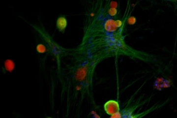 Colorful microscope image of female neurons and prolactin receptors