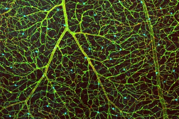 This image shows the blood vessels in a retina in green, the cells that make up the blood-retina barrier in red, and dopamine-producing amacrine cells in cyan.